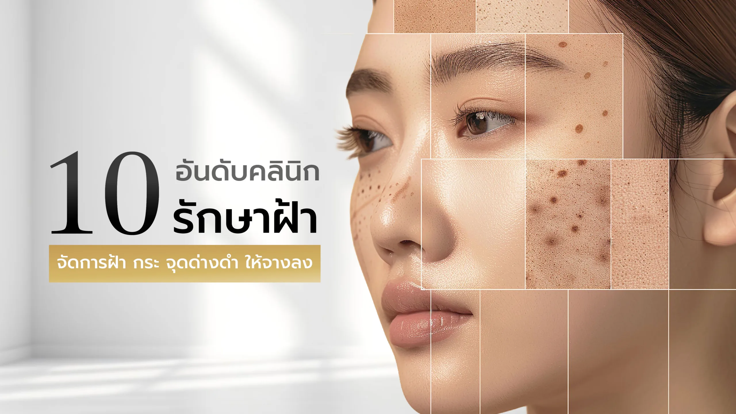 10 อันดับ คลินิกรักษาฝ้า กระ จุดด่างดำ ให้จางลง หน้าใสขึ้น