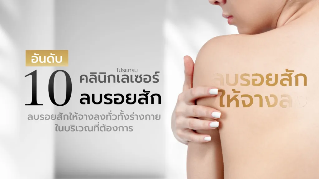 10 อันดับ คลินิกเลเซอร์ลบรอยสัก รอยสักจาง ทั้งผิว คิ้ว ปาก
